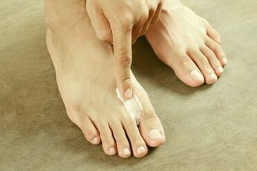 Use cream for toenail fungus